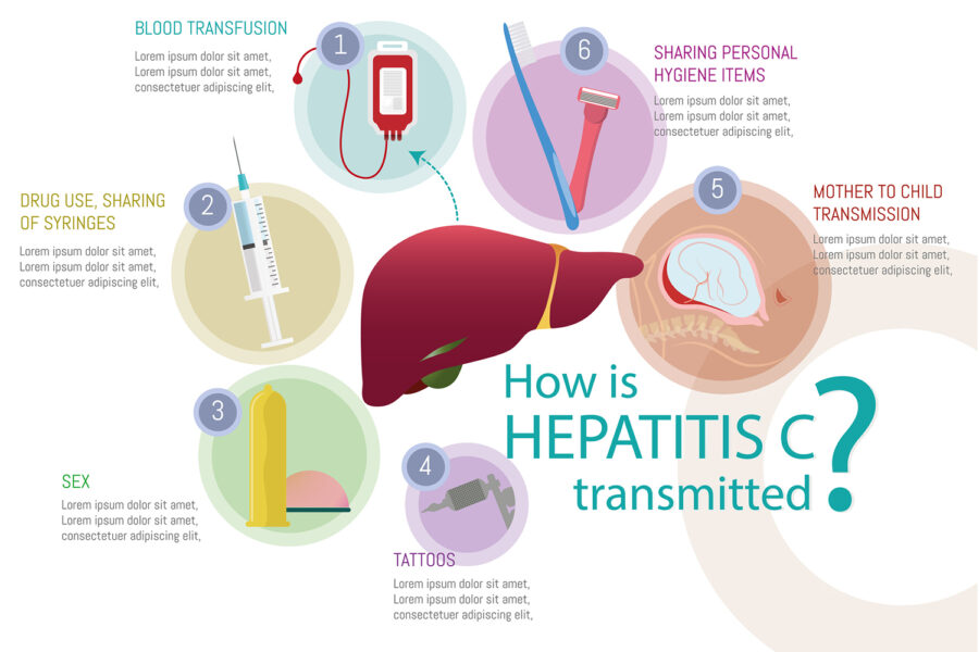 hepatitis a